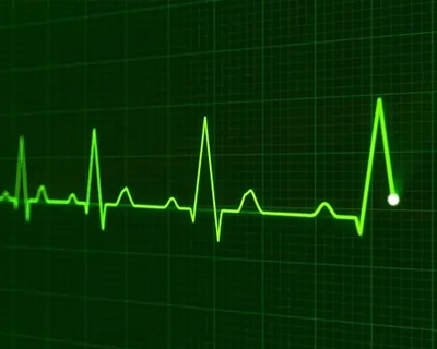 Electrocardiogram (ECG) Measurement